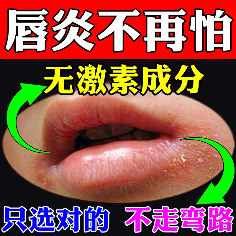房直售  唇炎专用草唇膏慢性修复烂嘴角口周口角炎上火嘴唇起泡防 单