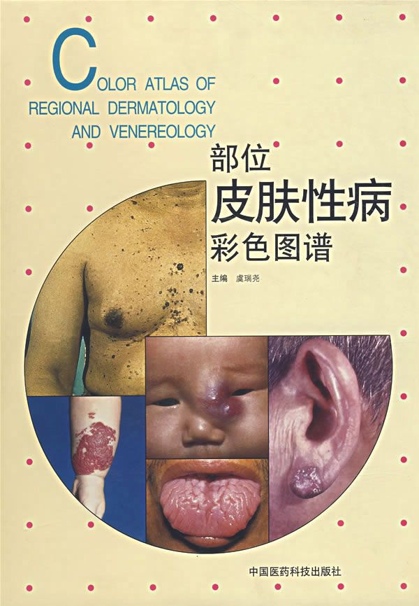 部位皮肤性病彩色图谱9787506720