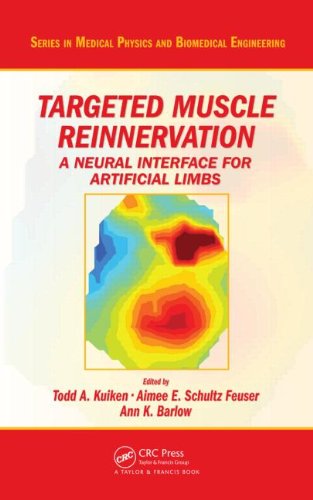 预订 targeted muscle reinnervation