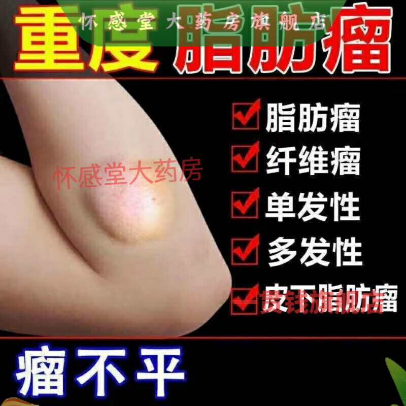 【大药房直售】脂肪瘤专消36种皮下多发性脂肪瘤硬块肿块去粉瘤囊肿