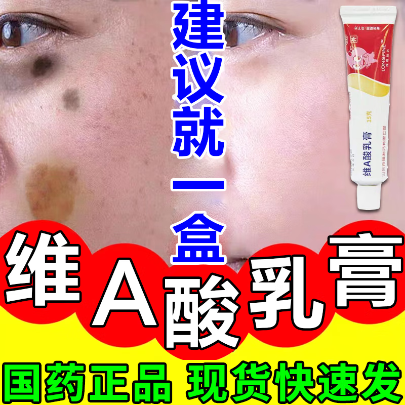 维a酸乳膏黑棘皮病治角化脖子黑色素去看除黑色素沉淀去看除看唇周