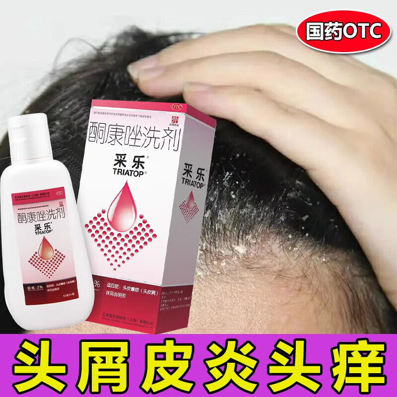 采乐酮康唑洗剂 洗发水医用 头皮糠疹头皮屑治疗 头皮瘙痒皮炎大块