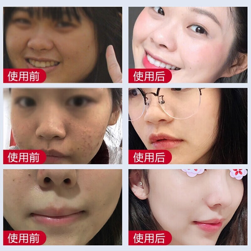 白云山星群美白祛斑洗面奶淡斑各种斑点黄暗提亮肤色深层清洁保湿洁面乳男女 1瓶装【推荐2瓶划算】