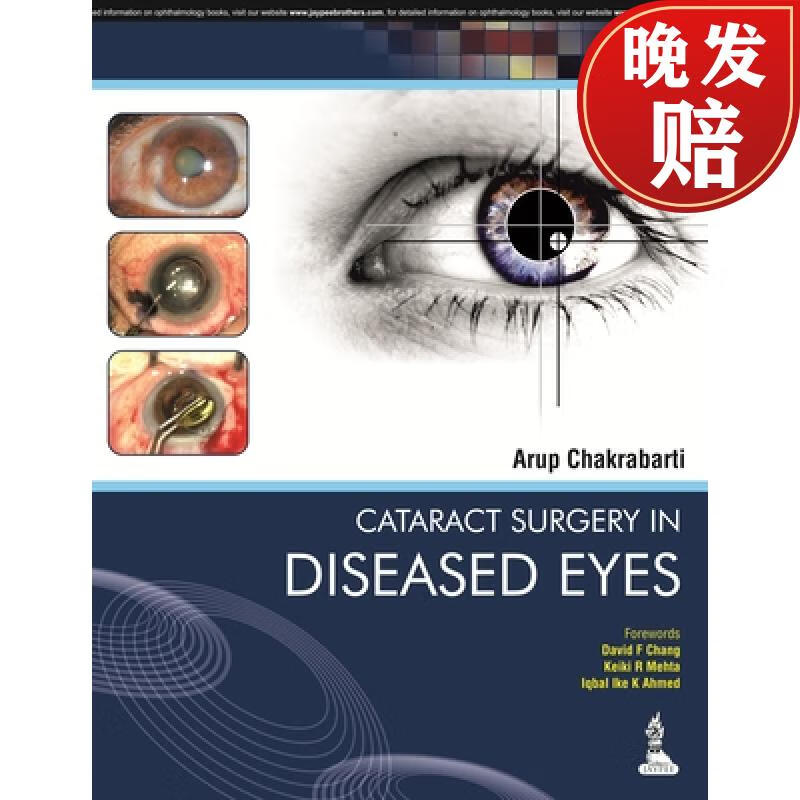 【4周达】cataract surgery in diseased eyes