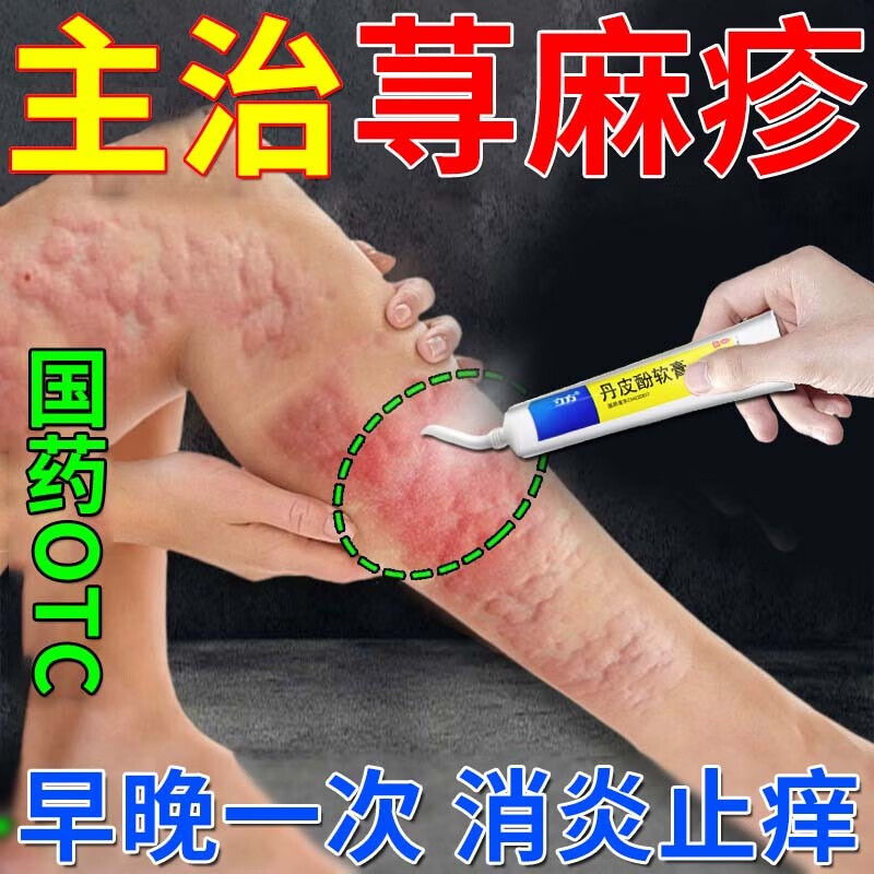 专科用药中药治疗荨麻疹过敏止痒断根祛风止痒治荨麻疹瘙痒药外敷药膏