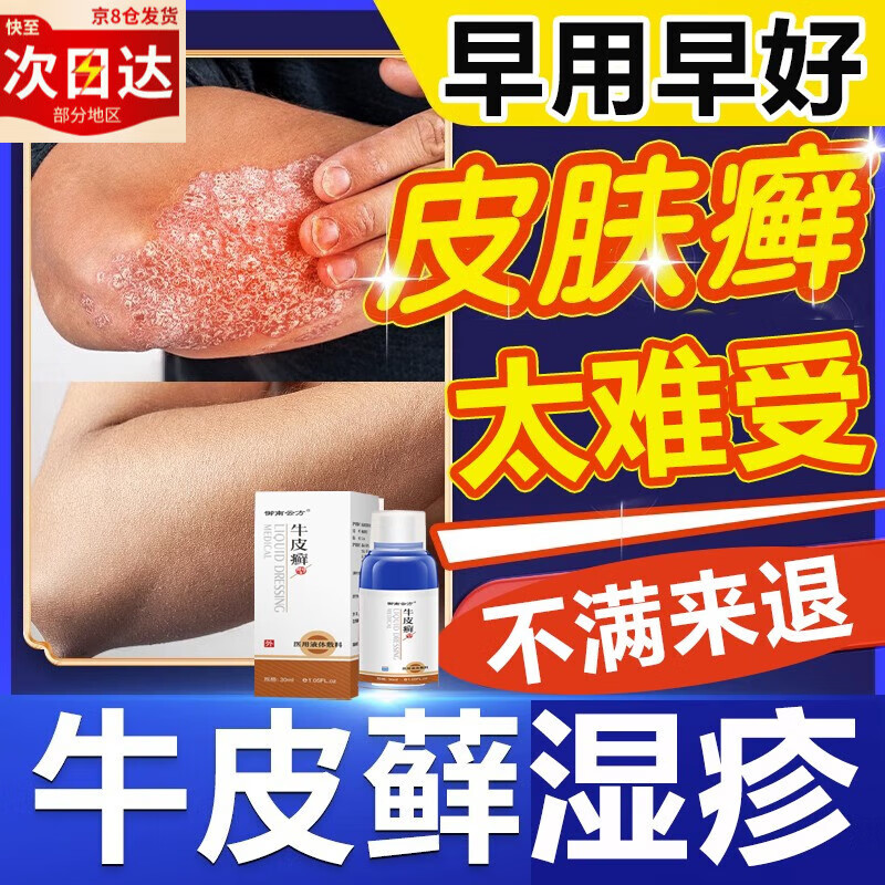 牛i皮癣专用中非药顽固银屑涂病外用头部股癣手i足癣立净顽癣喷剂 单