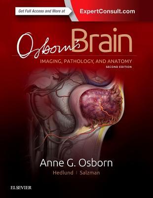 预订 osborn"s brain, 特种医学