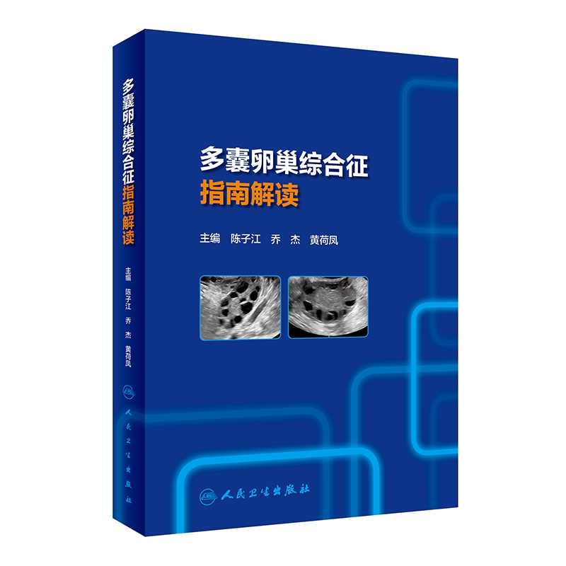 多囊卵巢综合征指南解读
