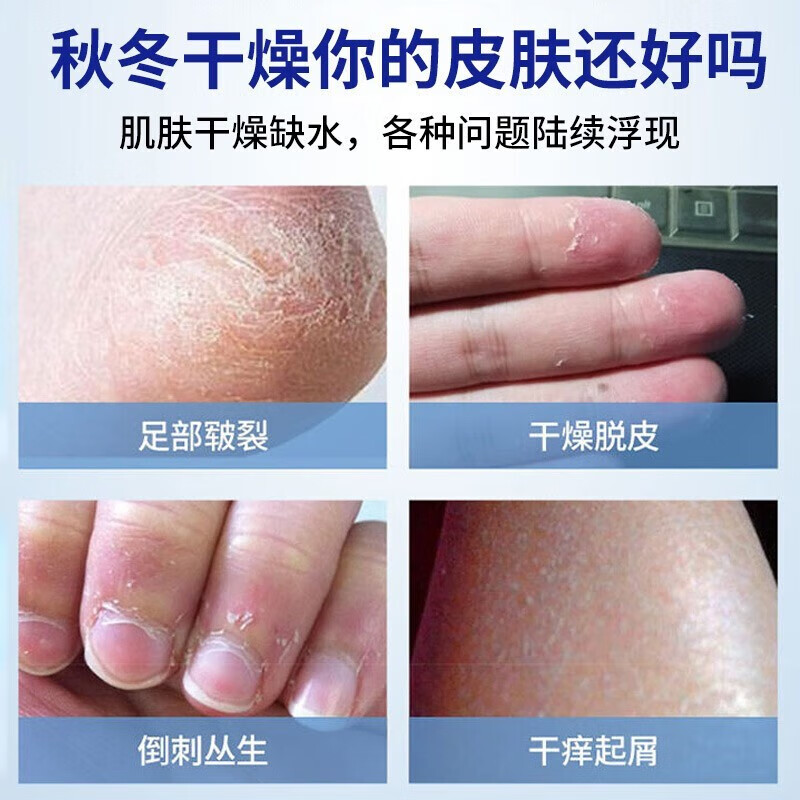 东半球裂可宁护手霜 滋润保湿身体乳防干裂手足霜皲裂膏脚后跟冻伤膏85g 裂可宁85g*3盒