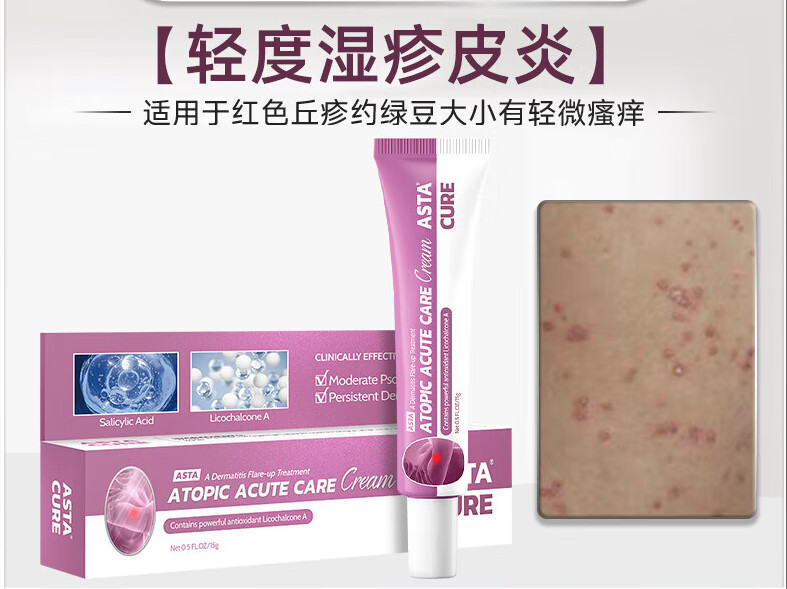 湿疹膏湿疹不痒去根外用顽固皮炎股藓专用薬大腿内侧瘙痒 astacure