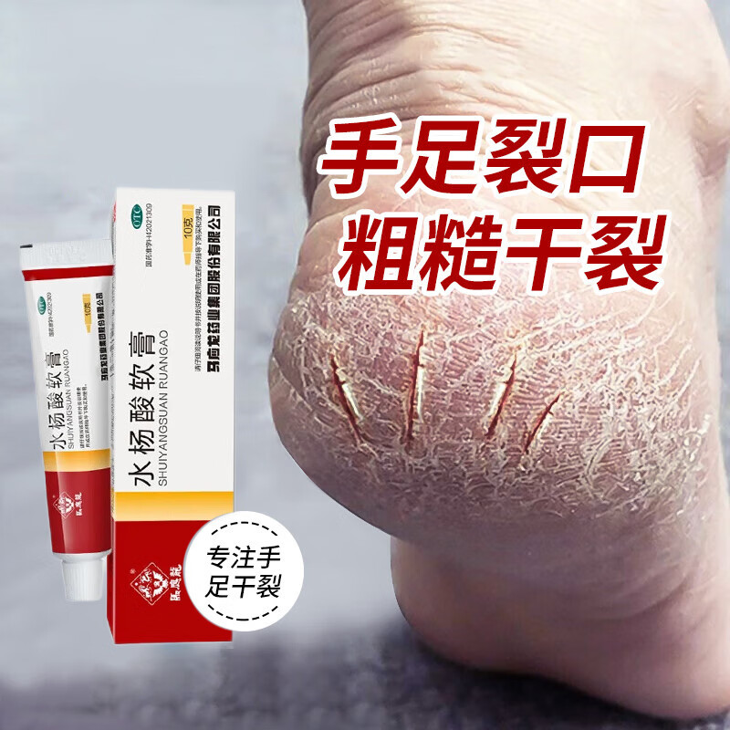 药膏手指开裂的药水杨酸软膏手干燥脱皮开裂脚后跟干裂膏裂手裂脚用药