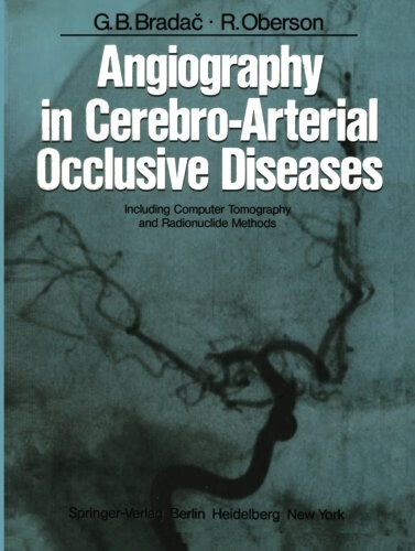 预订 angiography in cerebro-arterial occlusive diseases