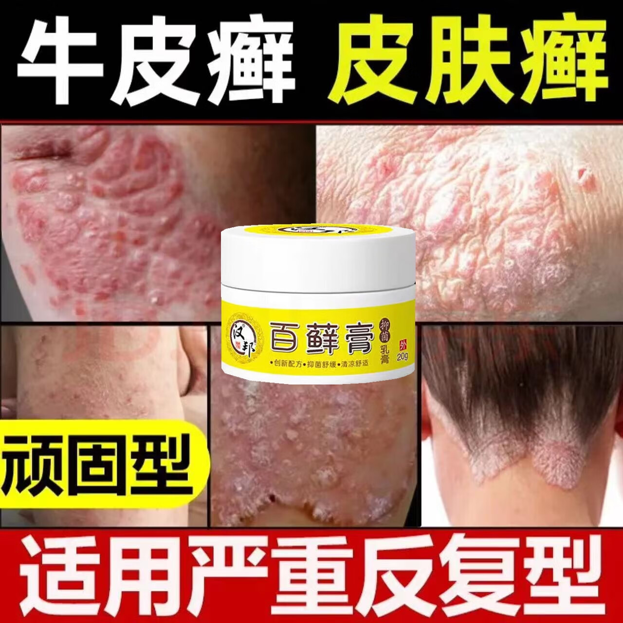 汉邦百藓膏牛l皮l藓银l屑l病头皮l癣手足l癣股l癣湿l疹皮l炎止痒膏 单