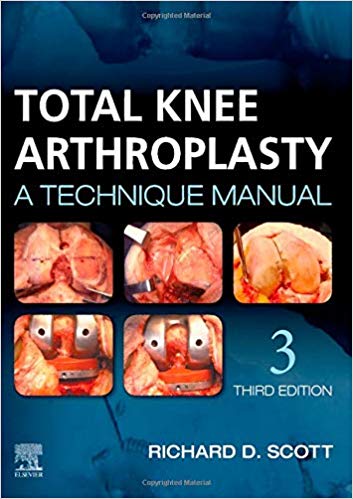 【预订】total knee arthroplasty