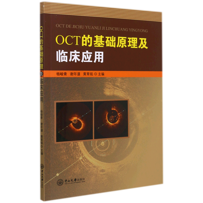 OCT的基础原理及临床应用