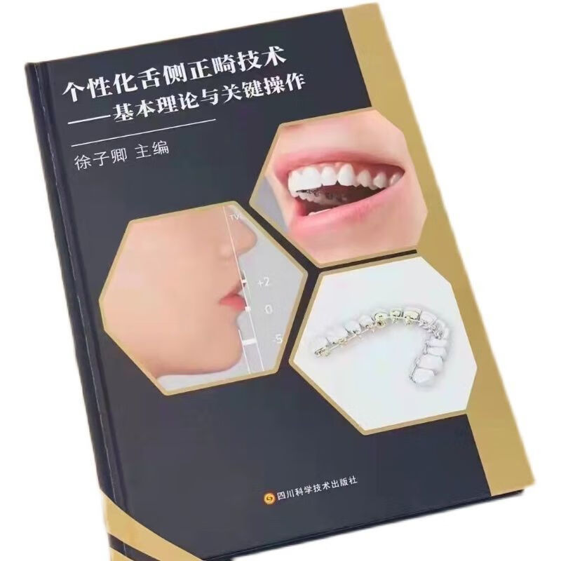 个性化舌侧正畸 基本与关键操作_徐子卿主编(彩图)