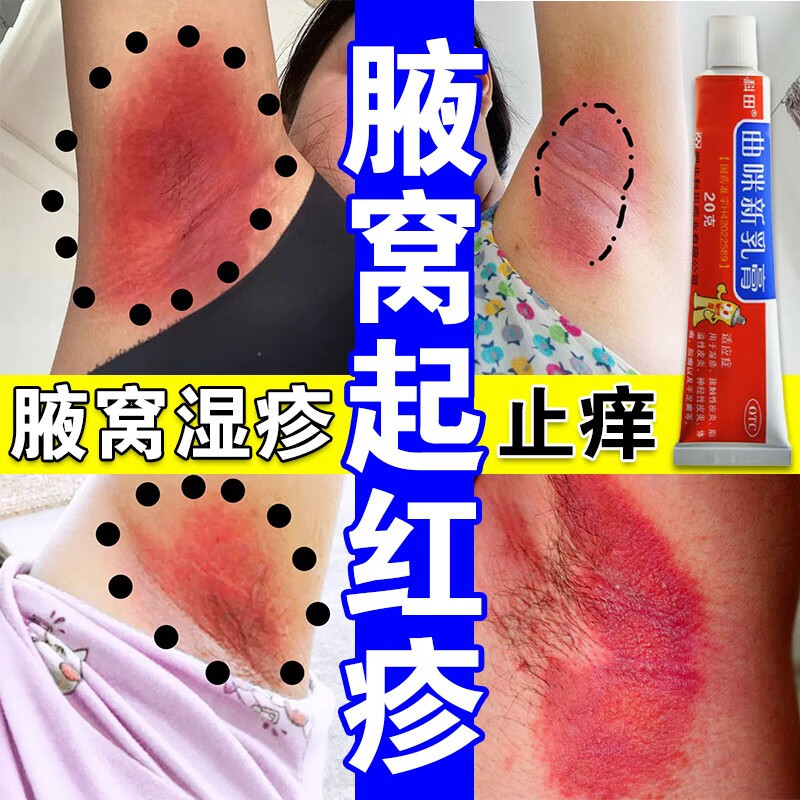 腋窝下红疹腋窝红痒起疹子腋窝红肿不舒服腋下湿疹红肿疼瘙痒止痒私处