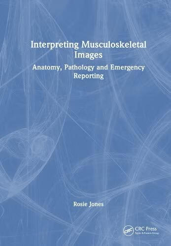 预订 interpreting musculoskeletal images: anatomy, pathology and