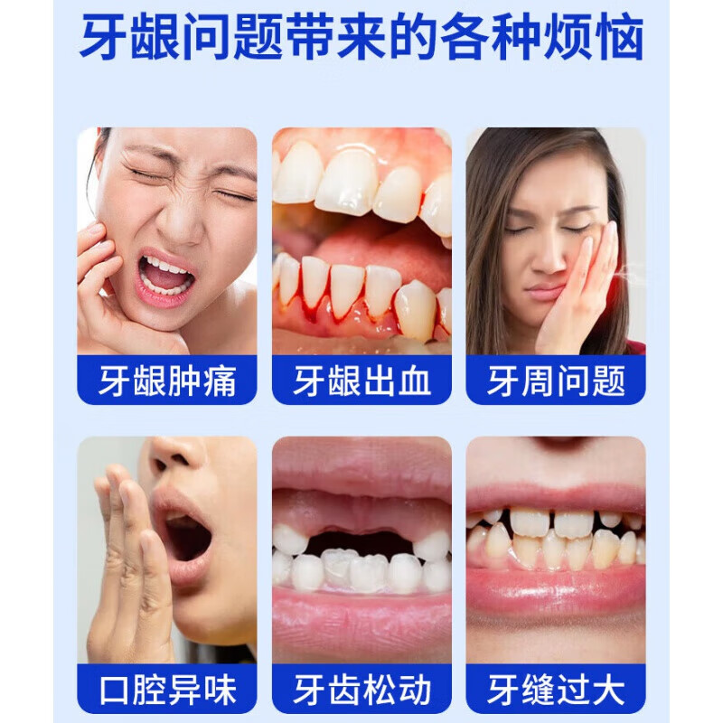 祖医堂牙科分离剂牙护牙周炎药牙龈萎缩牙齿松动固齿护牙修复药房直售 3盒疗程装 祖医堂牙科分离剂