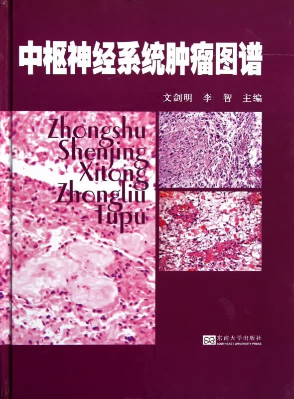 中枢神经系统肿瘤图谱(精)