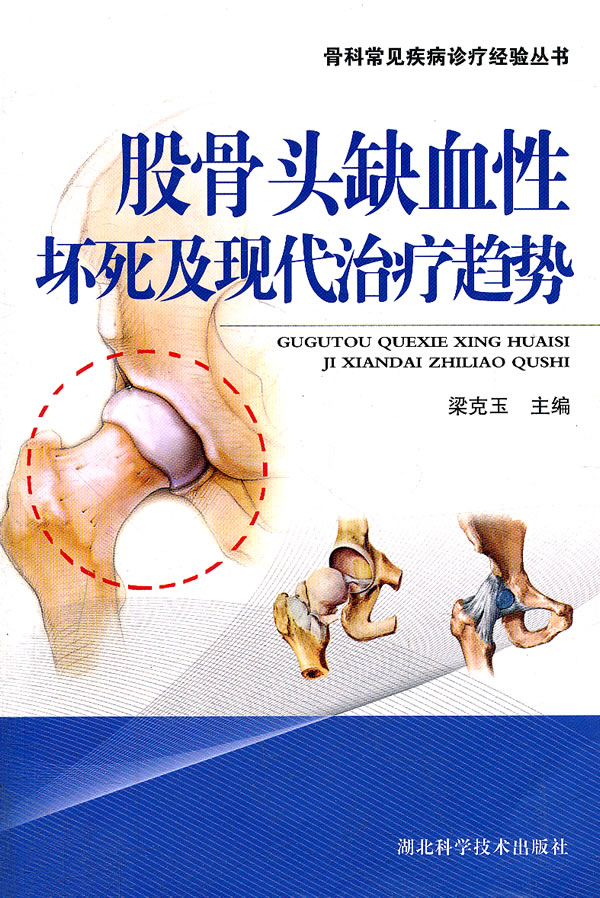 股骨头缺血性坏死及现代治疗趋势【放心选购】