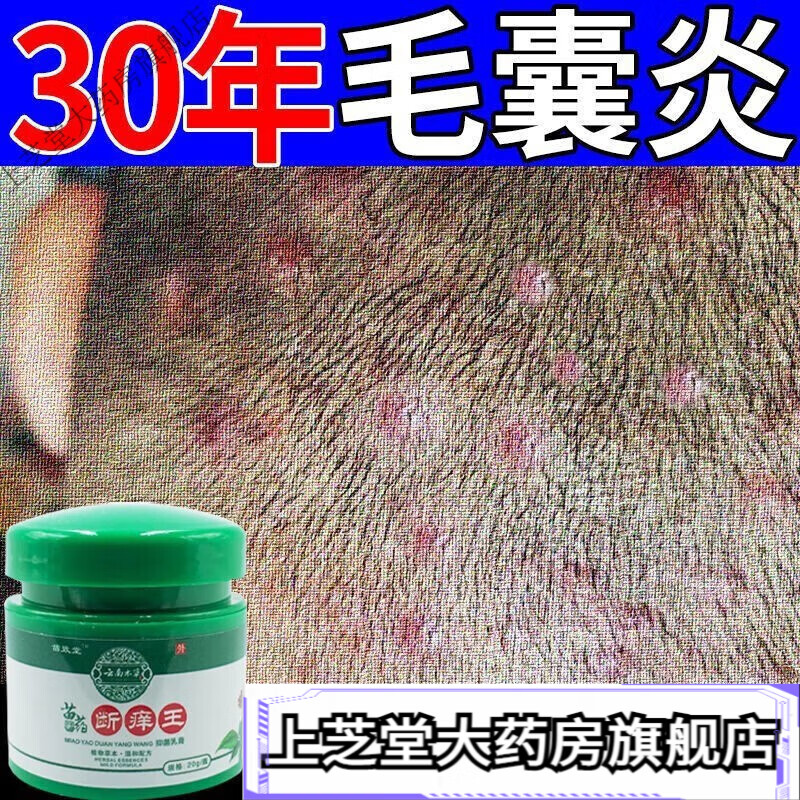 苗敬堂灭头皮头部背部脓包可以 1盒装