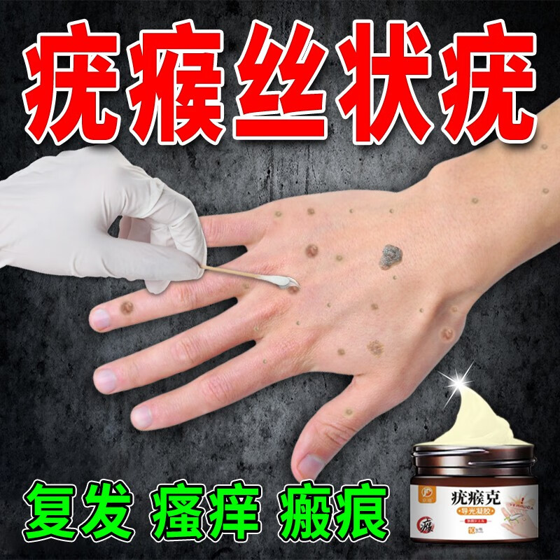 疣瘊灵不去除脖子小肉粒扁平疣专用面部脖子刺瘊子疣灵肉粒颈部去猴子
