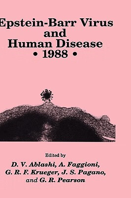 预订 epstein-barr virus and human disease 61 1988