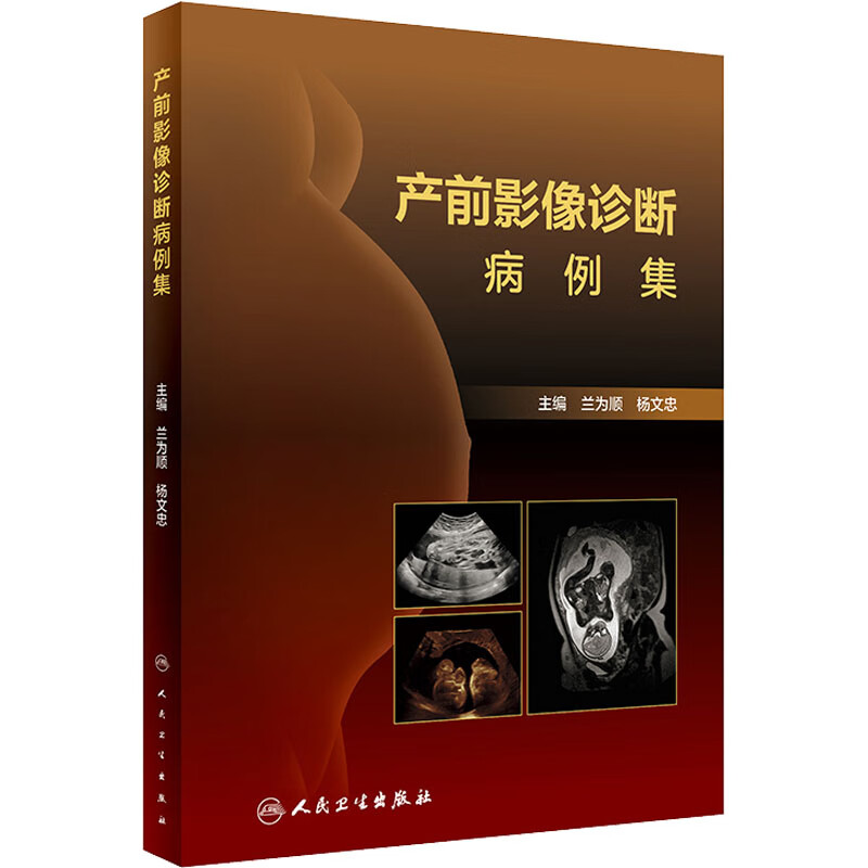 产前影像诊断病例集 图书