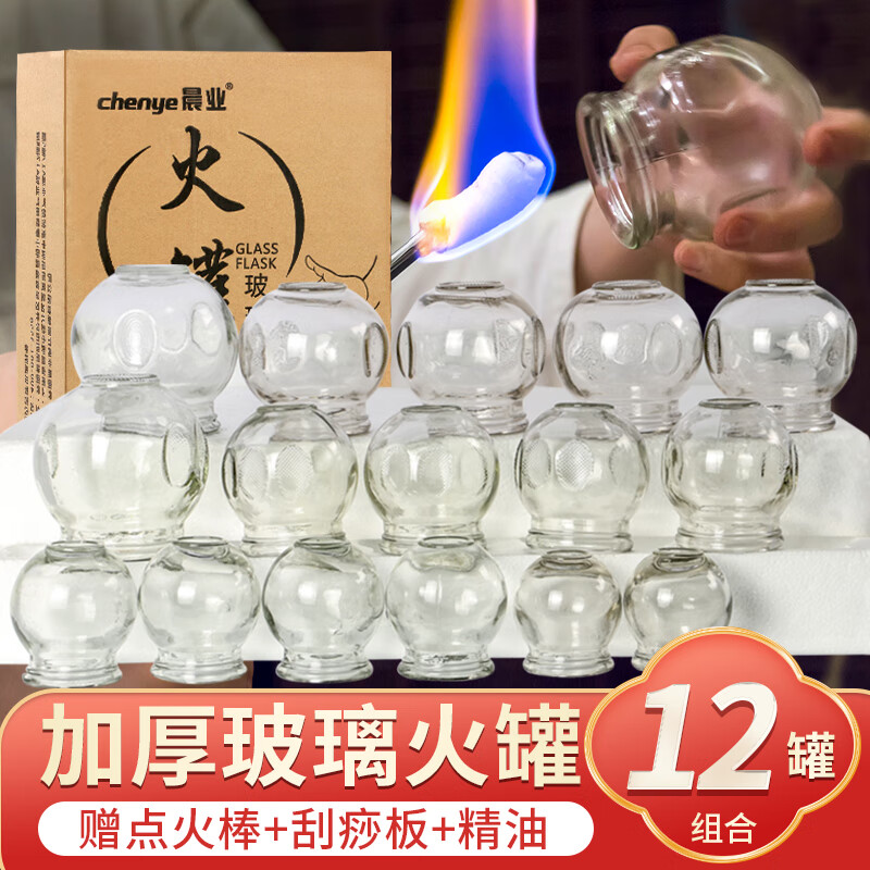 晨业拔火罐–性价比高的中医保健产品