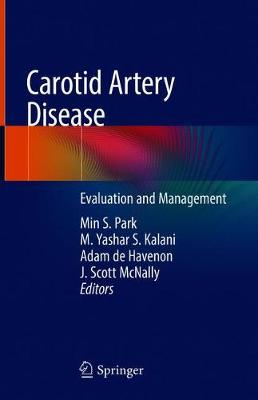 预订 carotid artery disease