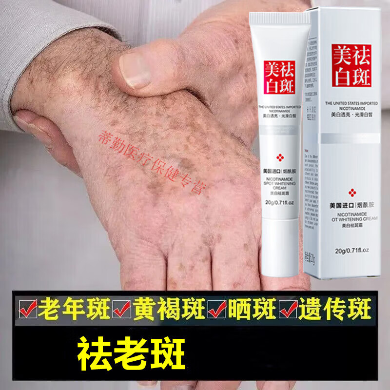 氢醌乳膏 黄白褐斑 祛斑霜去雀斑祛老年斑白斑官方品正手部脸部手