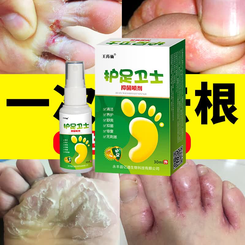 去真脚痒菌水泡脱皮烂脚丫喷剂泡脚药包去止菌痒药脚趾缝 15g