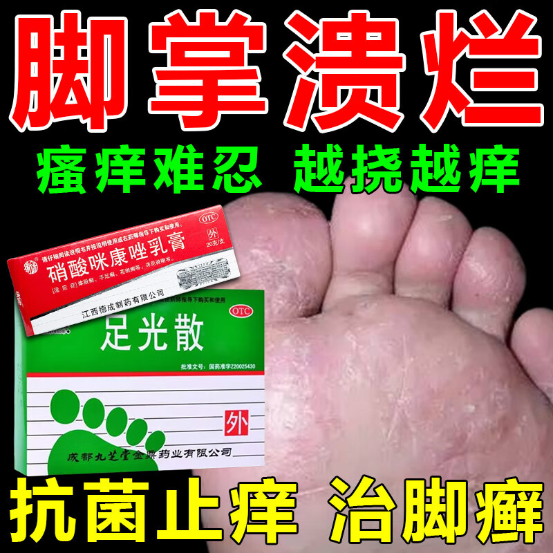 脚气药止痒脱皮烂脚丫真菌感染脚气膏止痒脱皮烂脚丫脚气根可搭配治