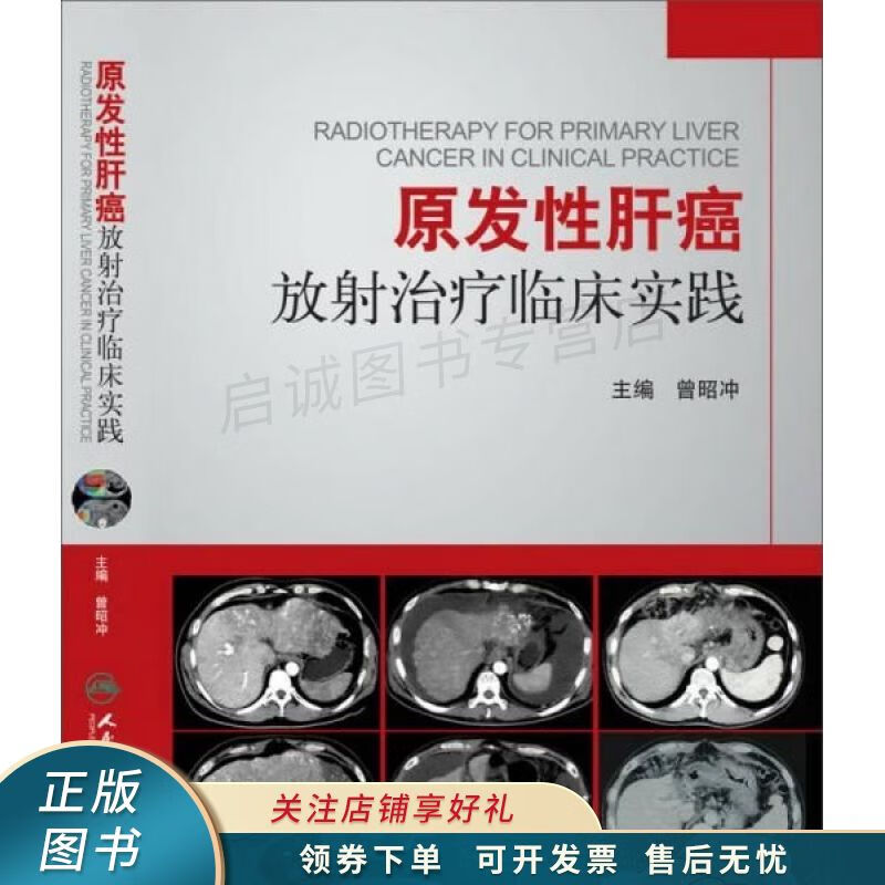原发性肝癌放射治疗临床实践 曾昭冲 【稀缺图书,放心购买】