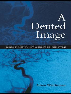 预订 a dented image: journeys of recovery from subar