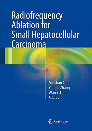 预订 radiofrequency ablation for small hepatocellular carcinoma