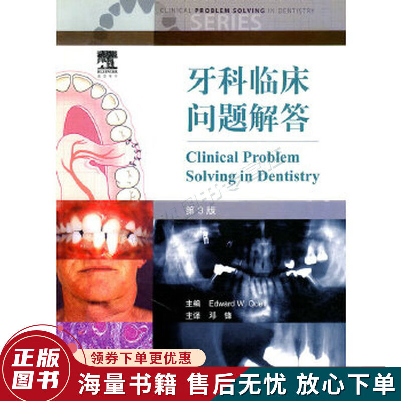 牙科临床问题解答第3版