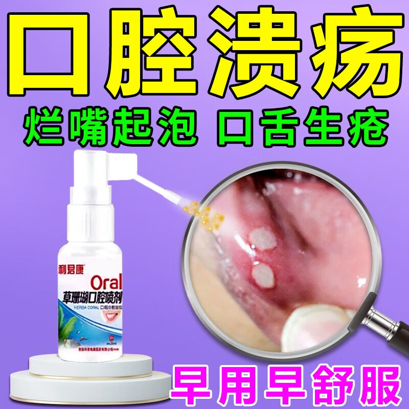 口腔溃疡喷剂治疗儿童反复性溃烂口疮舌头上火起泡专用的药喷雾 单