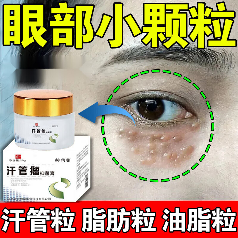 汗管瘤适用于眼部脂肪粒眼周白色颗粒油脂粒男女眼部抑菌膏 单盒
