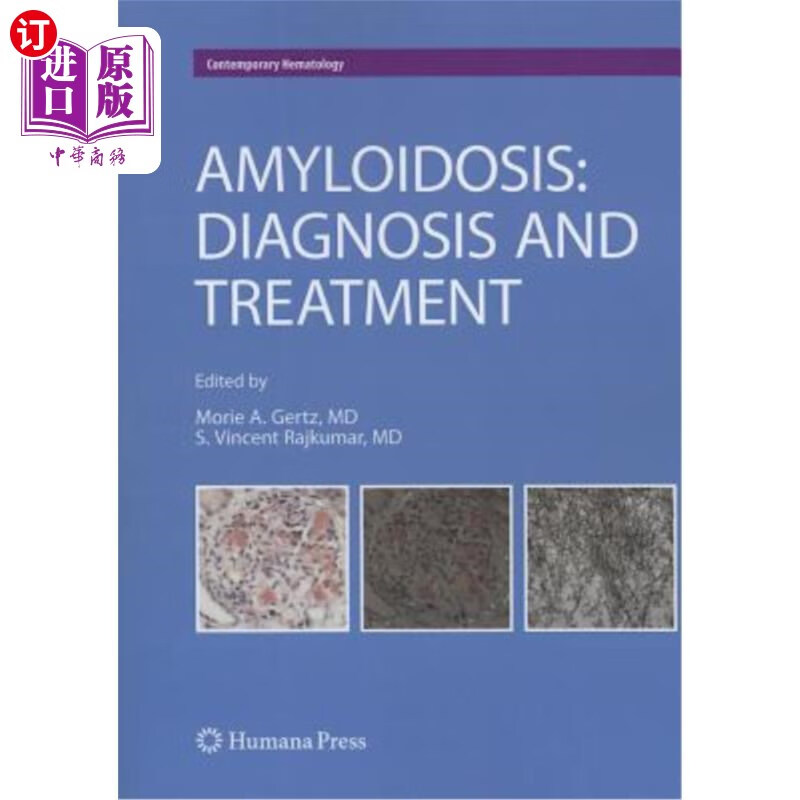 海外直订医药图书amyloidosis: diagnosis and treatment 淀粉样变性