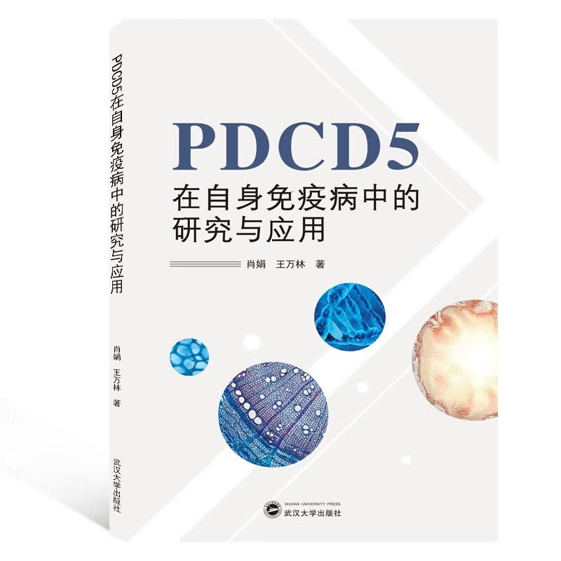 PDCD5在自身免疫病中的研究与应用
