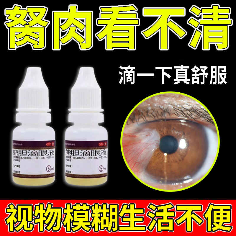 熊胆滴眼液 眼睛胬肉眼药水 治老年人眼神不好 眼球混住 结膜组织增生