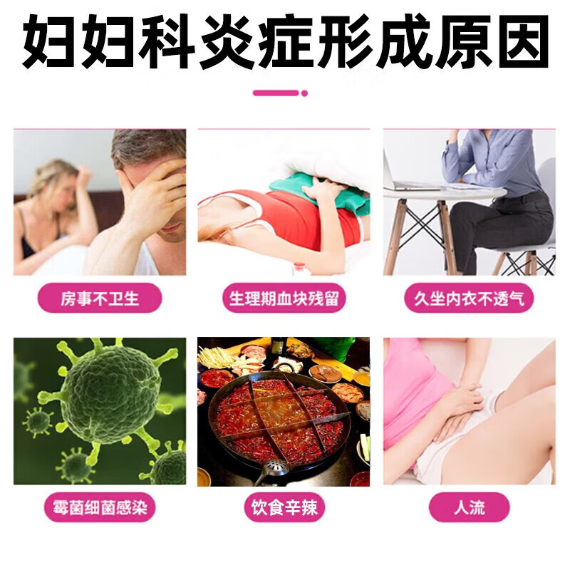 妇炎康片100片妇科炎症药阴道炎 盆腔炎盆腔积液小腹坠胀疼痛阴道瘙痒异味臭白带多豆腐渣 妇科用药 一盒装