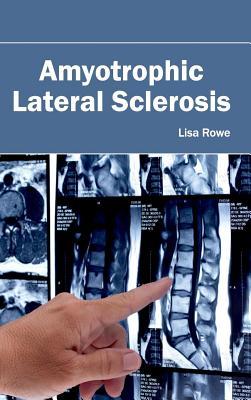 预订Amyotrophic Lateral Sclerosis