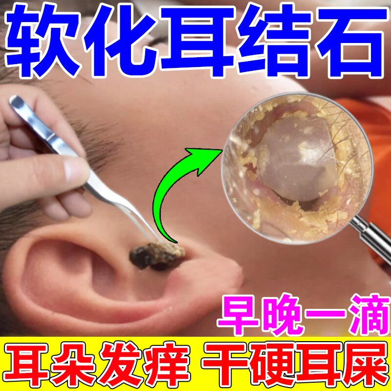 鹭凤堂耳结石软化水快速软化液一滴清除耳屎婴儿耳道清洗剂耵聍水止i