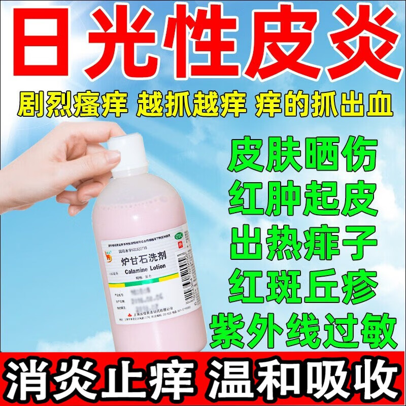 日光性皮炎药】炉甘石洗剂100ml用于晒伤红肿瘙痒修复紫外线过敏消毒