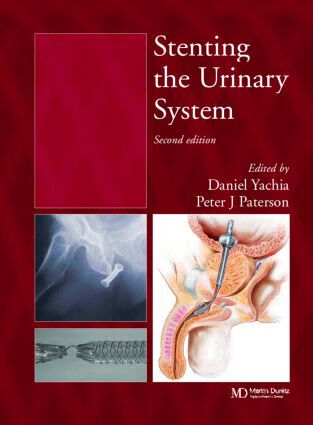 预订 stenting the urinary system, second edition