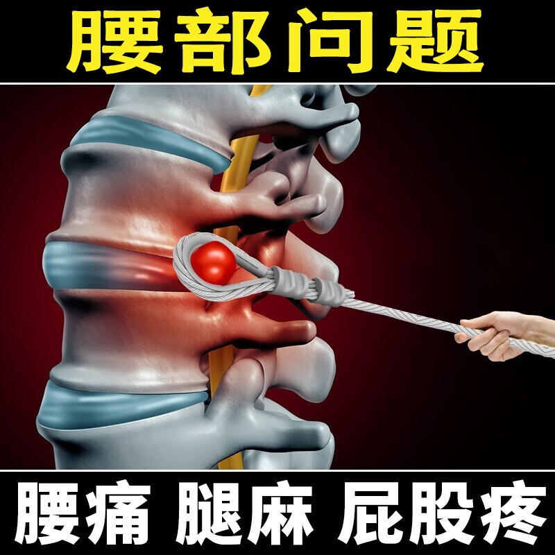 乔记本草腰椎部位型膏贴腰部疼痛坐骨神经腰腿疼痛骨宝冷敷凝胶腰椎