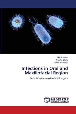 预订infections in oral and maxillofacial region